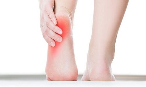 Topuk Dikeni (Plantar Fasiit) Nedir? Evde Çözüm Yolları